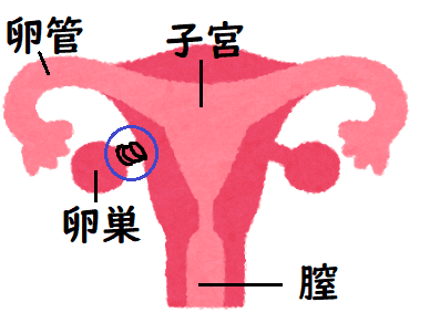 下腹部チクチク 茎捻転は激痛 卵巣嚢腫で腹腔鏡手術 生活を変えず年間１００万円貯蓄が増える ウシの家計簿主婦ブログー