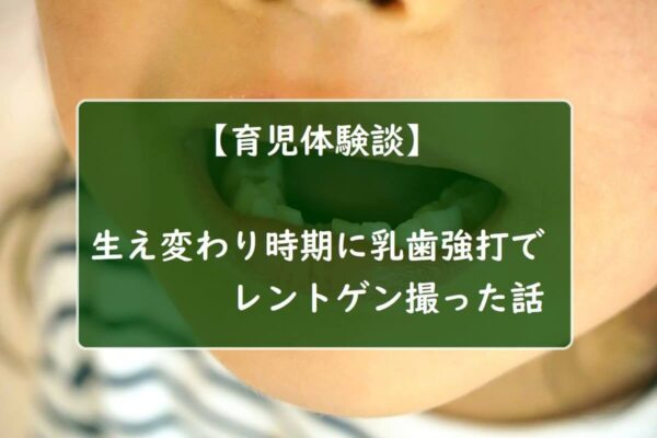 【育児体験談】生え変わり時期に乳歯強打でレントゲン撮った話
